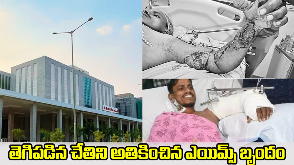 Rare treatment...AIIMS team grafts severed hand-DTv Telangana